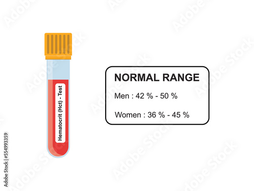 Hematocrit (Hct) Blood Test Concept Design. Vector Illustration.