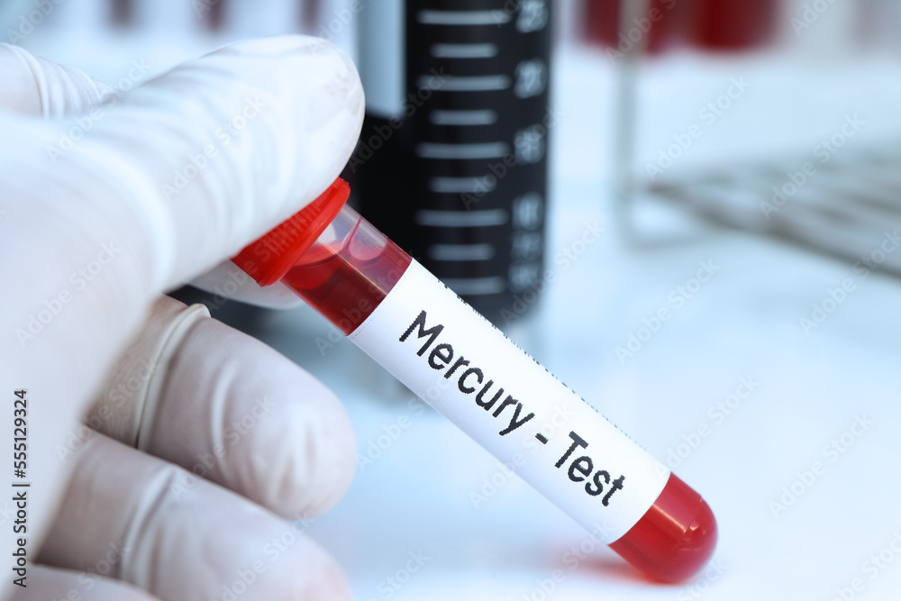 Fototapeta premium Mercury test to look for abnormalities from blood