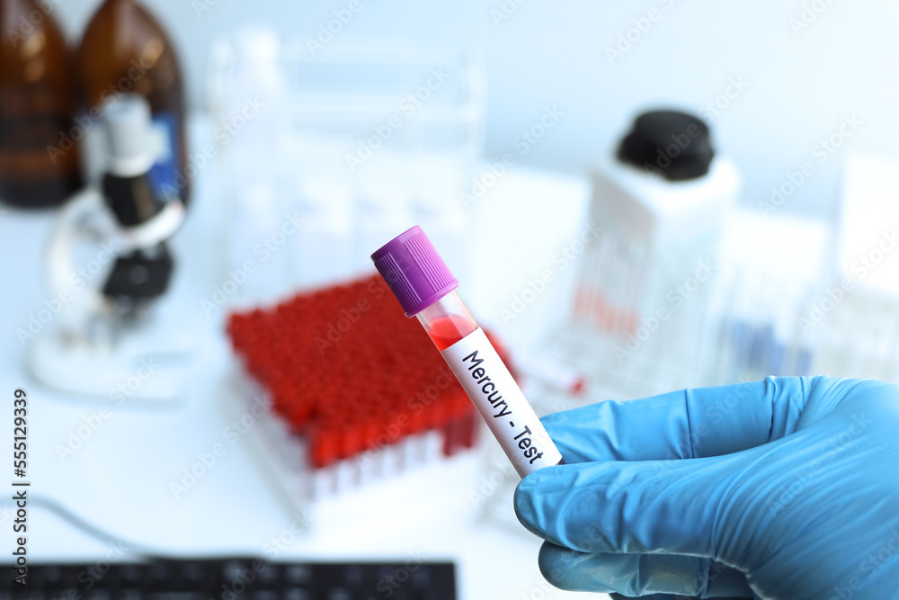 Mercury test to look for abnormalities from blood Mercury test to look for abnormalities from blood