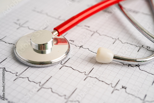 Stethoscope on electrocardiogram ECG, heart wave, heart attack, cardiogram report.