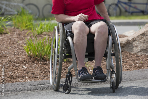 Woman with degenerative hip in a wheelchair photo