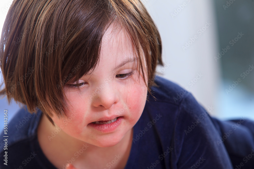 Little girl with Down Syndrome Little girl with Down Syndrome