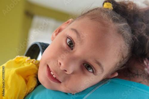 Small girl with Cerebral Palsy