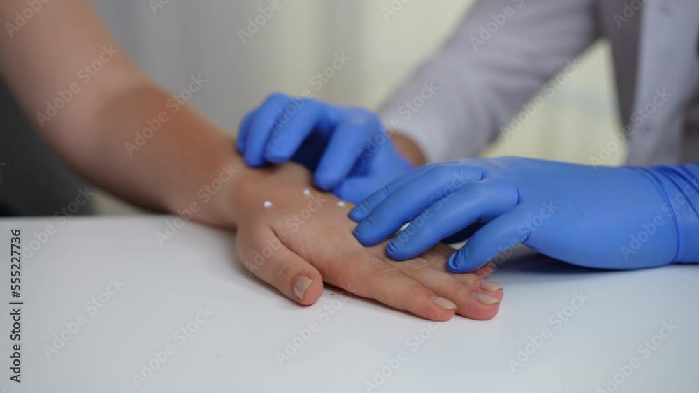 Closeup doctor hands in gloves examining monkeypox rash on female hand