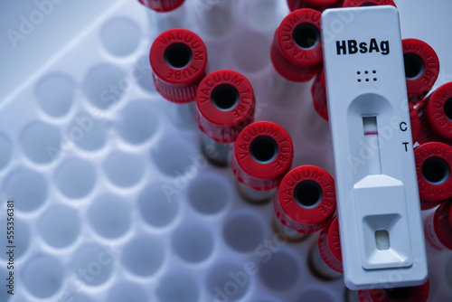 Rapid test cassette for Hepatitis B Virus Test (HBsAg) on a above the red vacuum tube. shows a negative result.Copy space photo