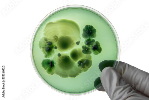 Hand with Petri dish or culture media with bacteria on white background with clipping, Test various germs, virus, Coronavirus, COVID-19, Microbial population count, Food science.