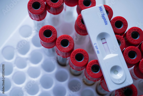 фотографія rapid test cassette of HIV showing negative test result