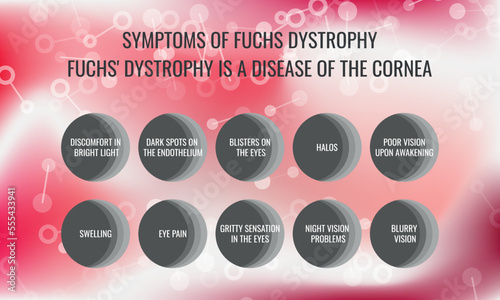 symptoms of fuchs dystrophy. Vector illustration for medical journal or brochure.