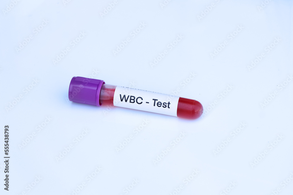 WBC test to look for abnormalities from blood WBC test to look for abnormalities from blood
