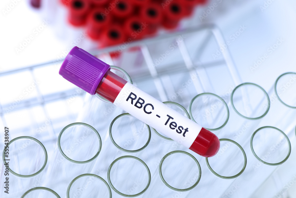 RBC test to look for abnormalities from blood