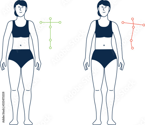Wrong and right body posture. Woman spine aligment photo