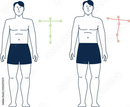 Man spine position. Good and bad posture. Standing person