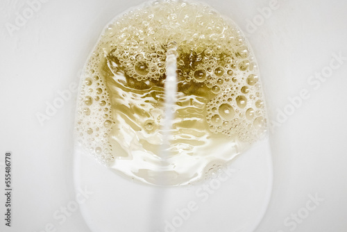The lavatory in the toilet and the stream of urine during urination