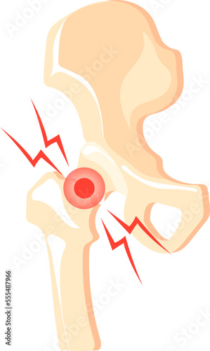 Hip joint pain icon. Cartoon bone ache