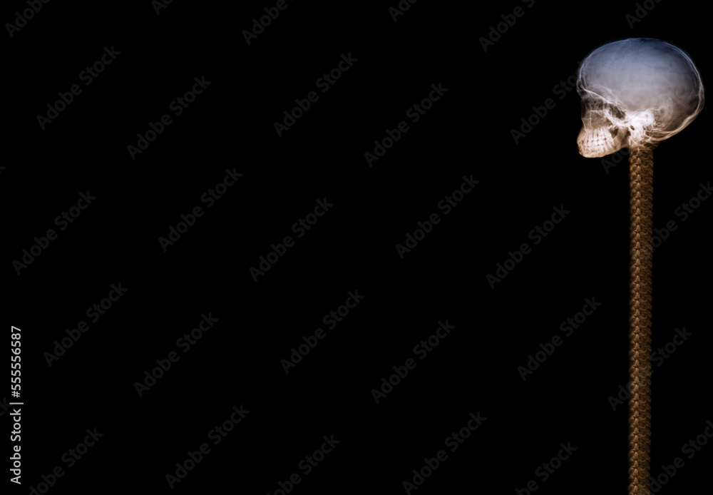 Side view of a skull, Human head on colour x-ray film, isolated on black background, poster, banner