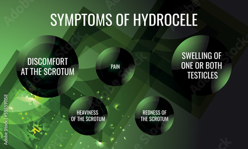 symptoms of Hydrocele. Vector illustration for medical journal or brochure.
