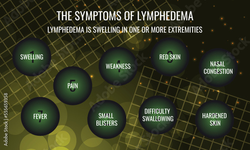 the symptoms of Lymphedema. Vector illustration for medical journal or brochure.