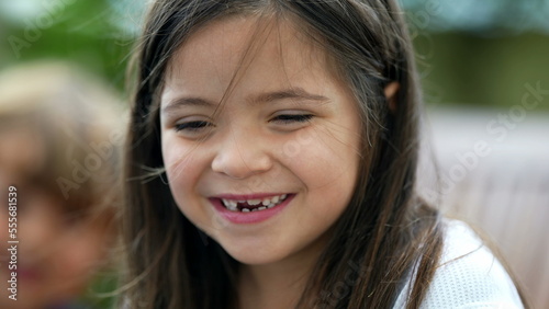 Portrait of a happy little girl closeup face with missing teeth. Joyful female child toothless front tooth smiling