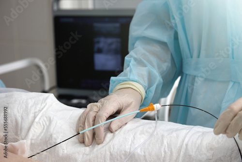 Vascular surgeon inserts catheter into vein treat varicose veins lower extremities cause diseased vein collapse and close. In hand surgeon in medical gown and gloves catheter treatment varicose veins