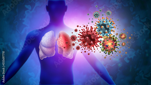 Triple Virus Lung Infection and Tripledemic Human lung infection and respiratory inflammation disease as influenza flu outbreak or pneumonia and pulmonary illness photo