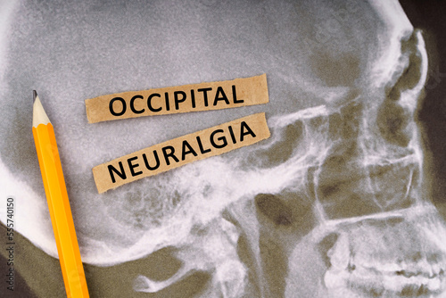 Fotografie On x-rays of a human skull, a pencil and strips of paper with the inscription -