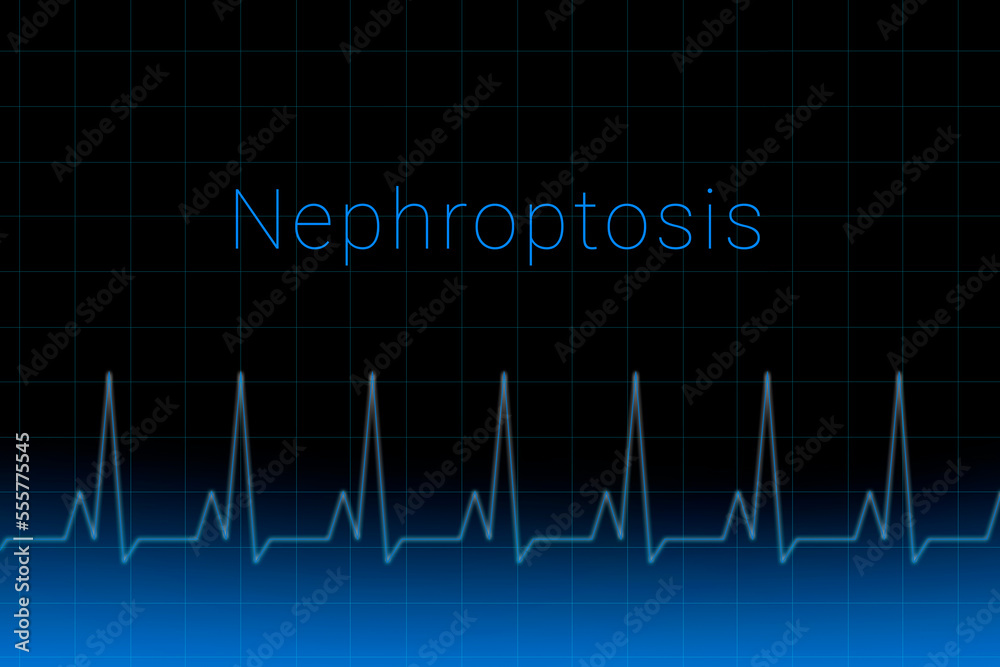 Nephroptosis disease. Nephroptosis logo on a dark background. Heartbeat line as a symbol of human disease. Concept Medication for disease Nephroptosis. Nephroptosis disease. Nephroptosis logo on a dark background. Heartbeat line as a symbol of human disease. Concept Medication for disease Nephroptosis.