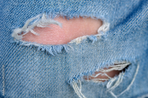Tear in Blue Jeans