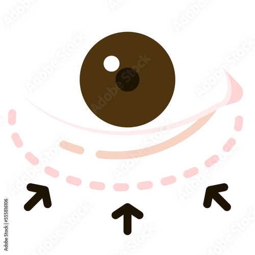 blepharoplasty flat icon