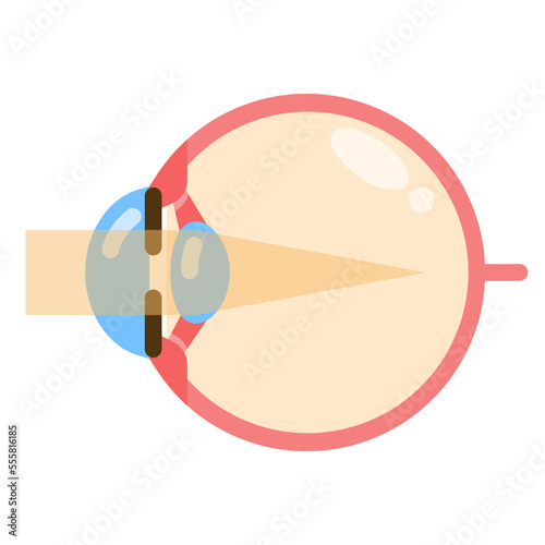 myopia flat icon photo
