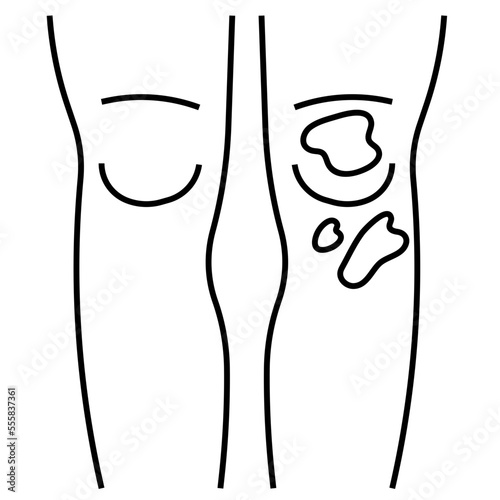 bruise line icon