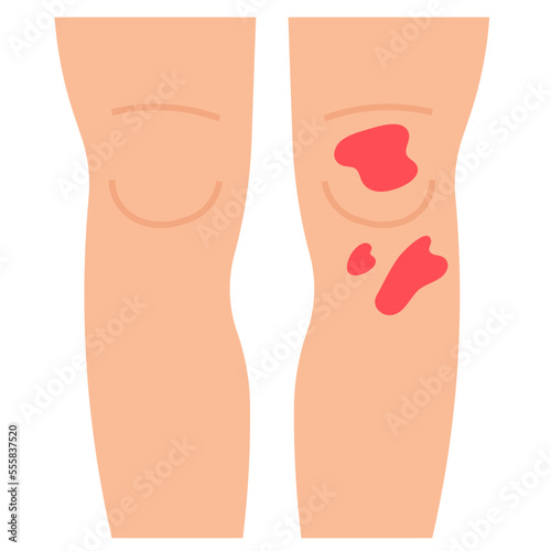 bruise flat icon