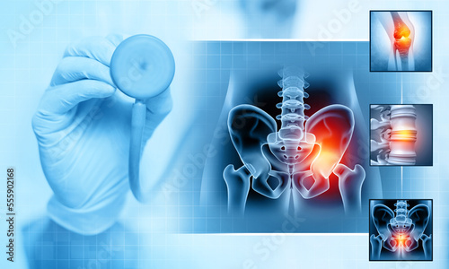 Fotografie Orthopaedist checks and diagnose the bones of the pelvis and hip, femur bone joint pain, X ray of the hip joint and femur