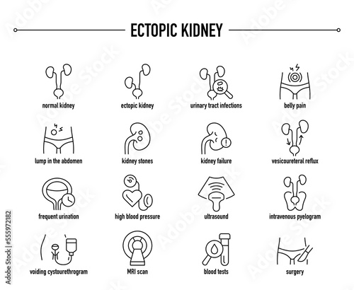 Ectopic Kidney symptoms, diagnostic and treatment vector icon set. Line editable medical icons.