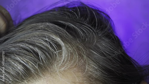 A young woman examines the gray hairs on her head. An early gray-haired girl touches her hair. macro video.