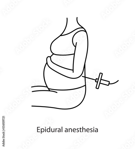 Epidural anesthesia before childbirth, line icon in vector.