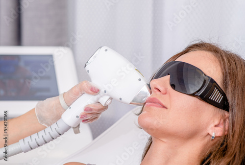 Professional beautician removes hair on the face of an young woman using a laser. Mustache removal, laser procedure at clinic