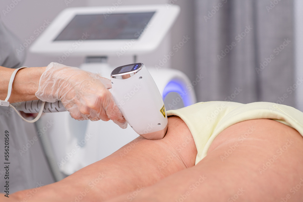 Professional beautician removes hair on female buttocks of senior woman