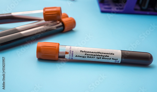 Toluenesulfonamide Formaldehyde  Allergy RAST IgE Blood Tests. Test tube on blue background photo