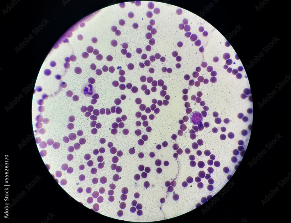 Colored blood smear sample under light microscope Colored blood smear sample under light microscope
