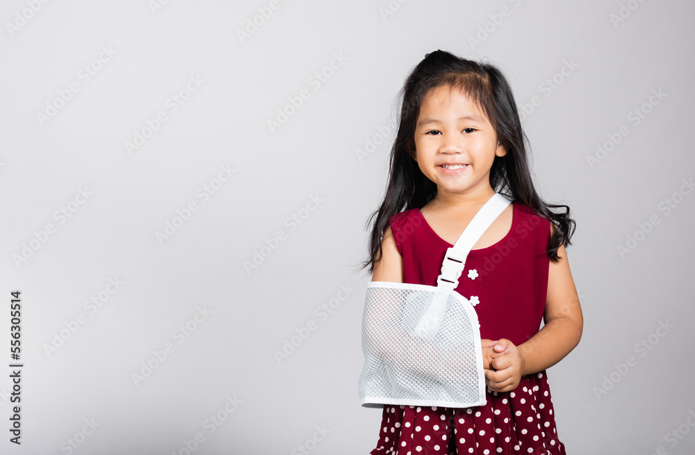 Arm broken. Little cute kid girl 3-4 years old hand bone broken from accident with arm splint in studio shot isolated on white background, Asian children preschool injured after accident, health Arm broken. Little cute kid girl 3-4 years old hand bone broken from accident with arm splint in studio shot isolated on white background, Asian children preschool injured after accident, health