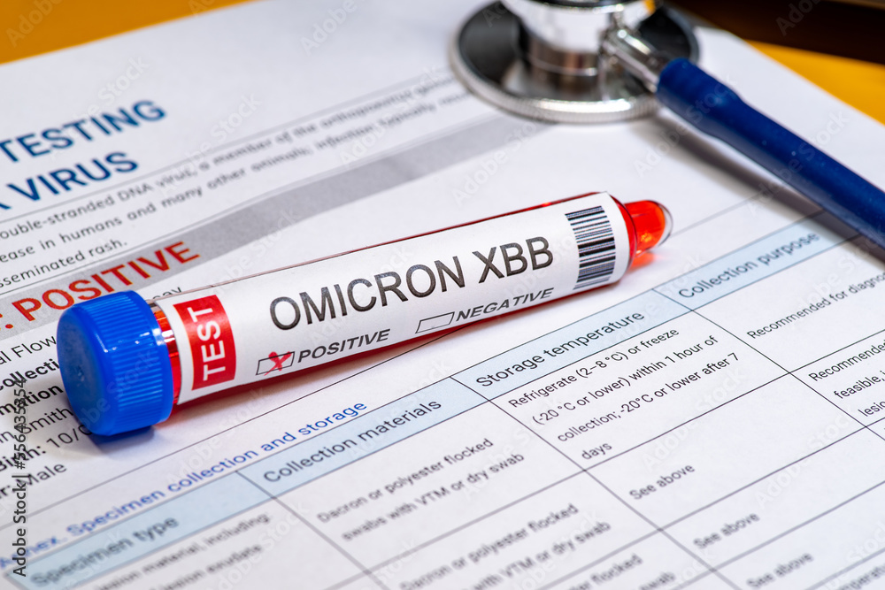 Obraz premium Test tube labelled 