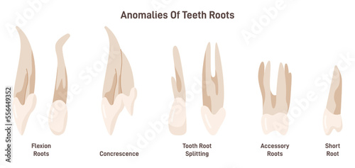 Anomalies of teeth roots. Adult human teeth, molar premolar canine incisor photo