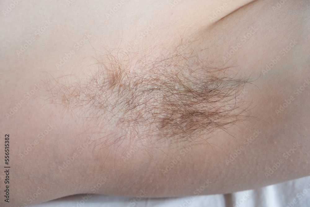 Female hairy armpit close up, body positive Female hairy armpit close up, body positive
