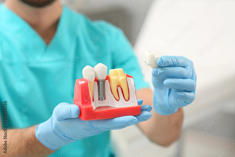 Dentist holding educational model of dental implant on blurred background, closeup Dentist holding educational model of dental implant on blurred background, closeup