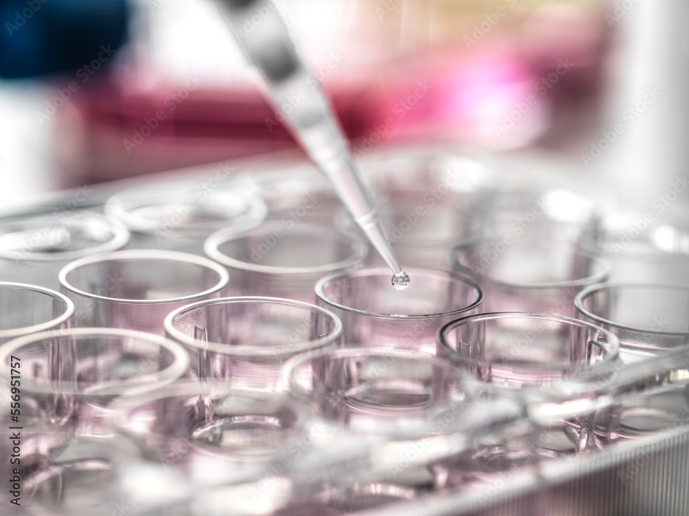 Samples in microplate being tested in laboratory Samples in microplate being tested in laboratory