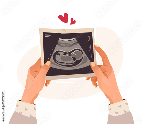 Hands holding a photo of a baby on ultrasound scan in the womb. Ultrasound of the child. Pregnancy. Cartoon vector illustration