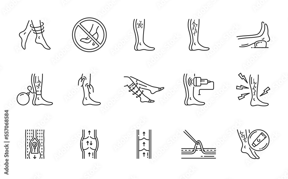 Varicose treatment icons, leg veins thrombosis disease and surgery