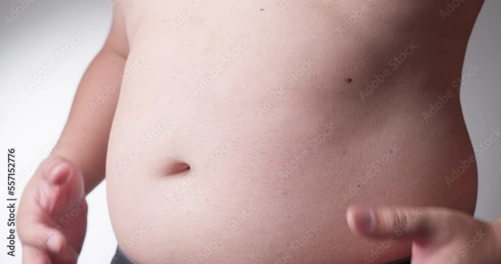 Close-up, male stomach, overweight. Young man with a naked fat belly shakes fat folds on his stomach, obesity, health, beer belly Close-up, male stomach, overweight. Young man with a naked fat belly shakes fat folds on his stomach, obesity, health, beer belly