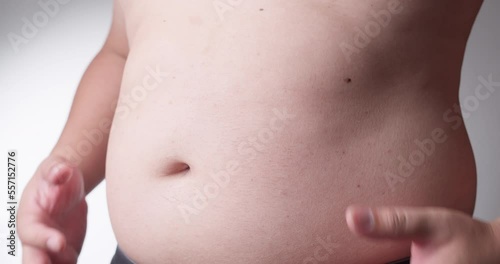Close-up, male stomach, overweight. Young man with a naked fat belly shakes fat folds on his stomach, obesity, health, beer belly
