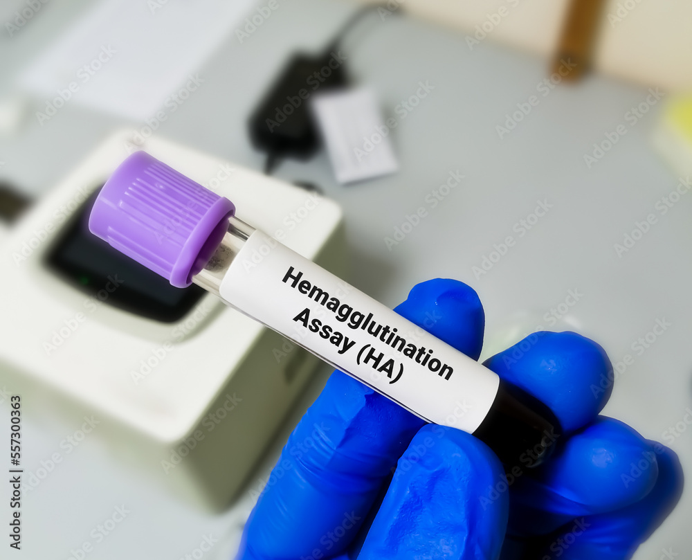 Blood sample for Hemagglutination Assay